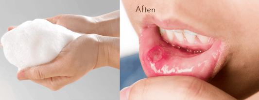 Waardoor ontstaan aften tijdens het tandenpoetsen?